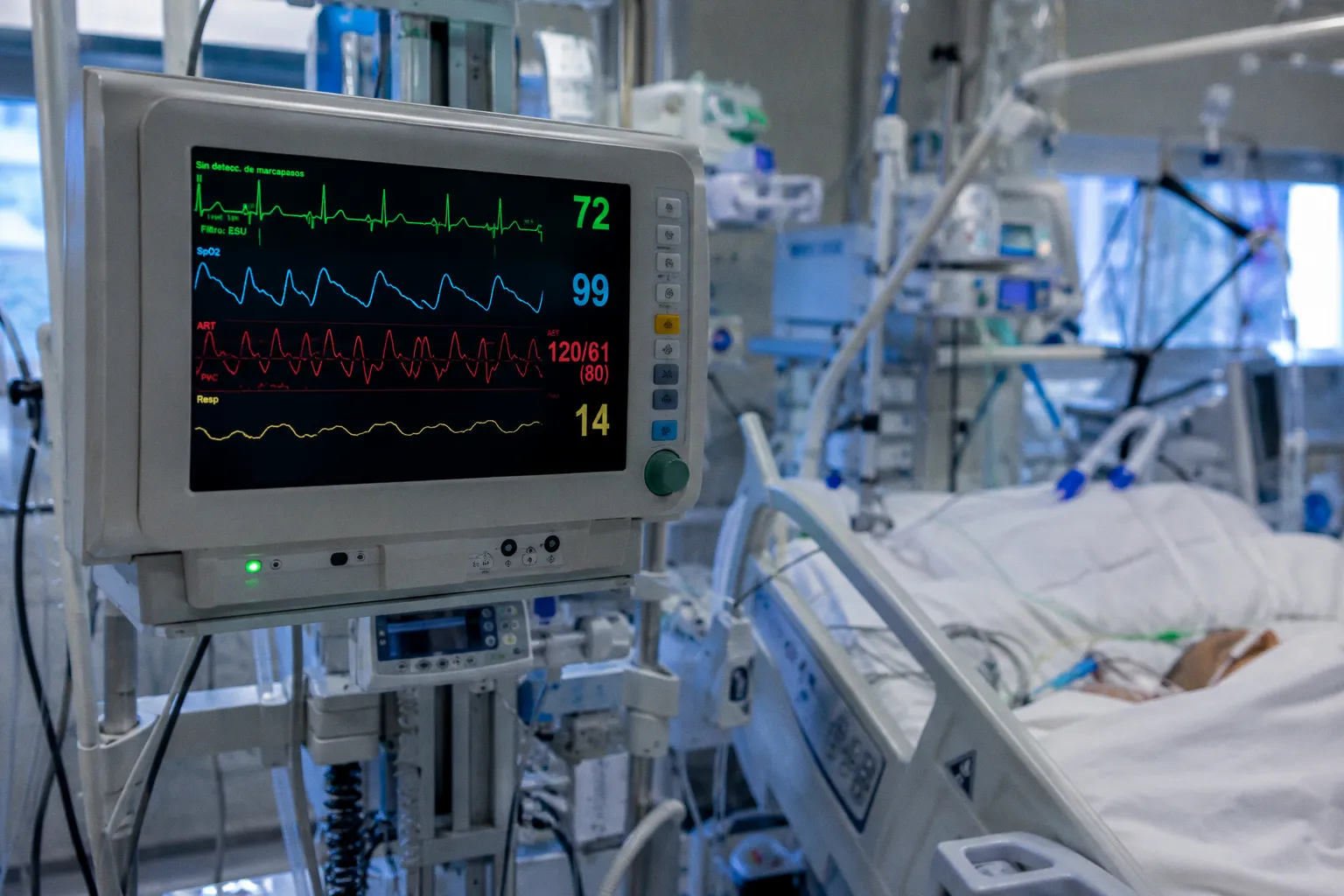 Algoritmos de IA para la detección precoz de cardiopatías en la UCI