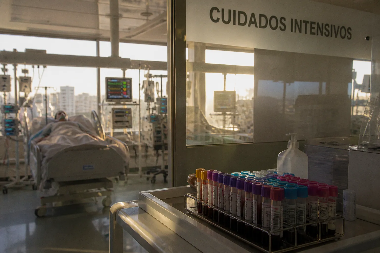 Identificados dos subtipos de lesión renal en sepsis mediante análisis proteómico