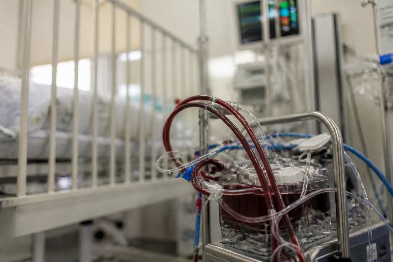 Viabilidad de la reanimación extracorpórea en paradas cardiacas pediátricas extrahospitalarias